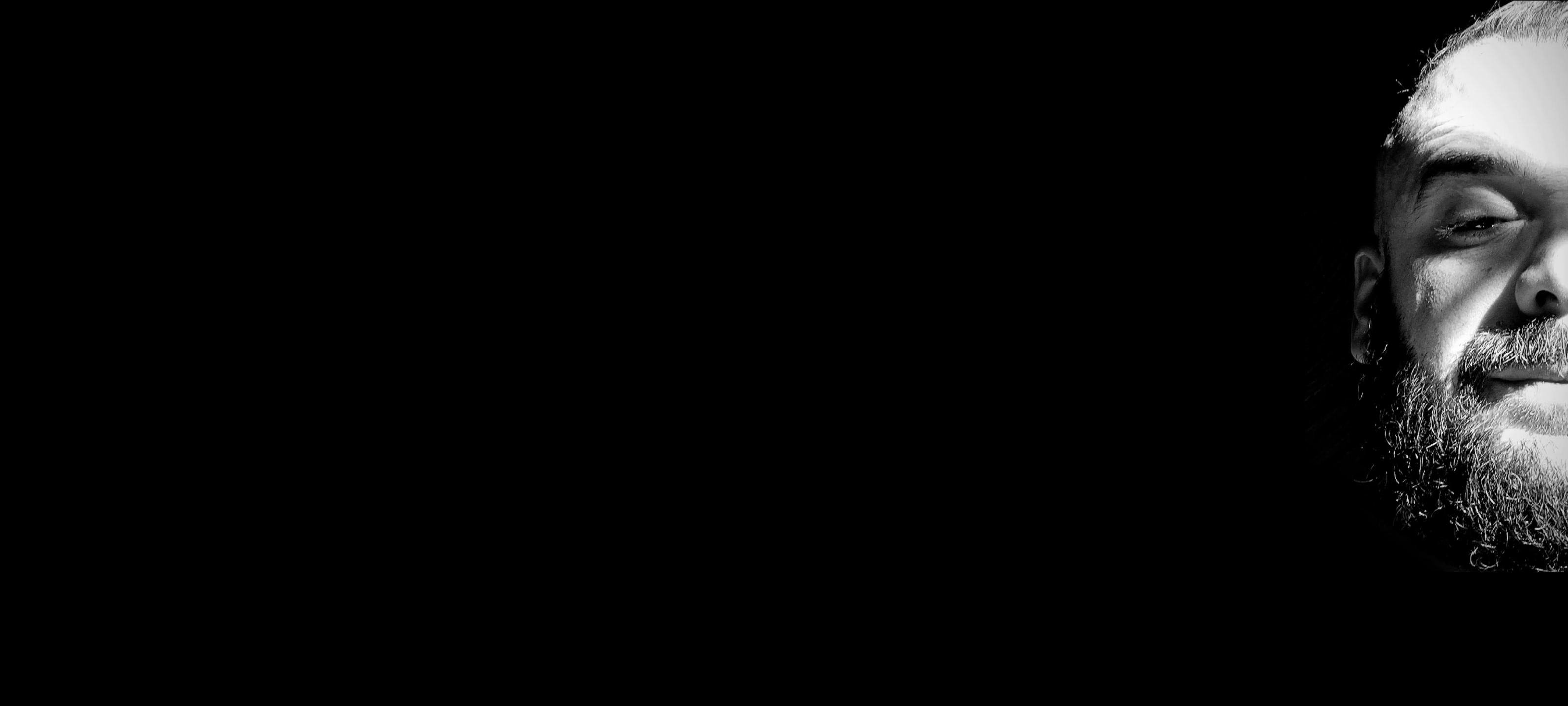 Tachycardia